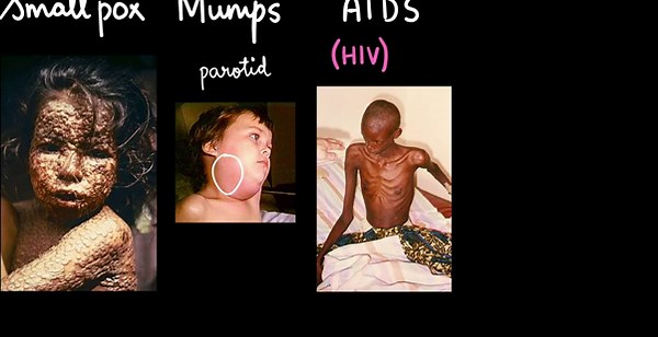 Virus - Part 2 | | Grade | Subject | Khan Academy