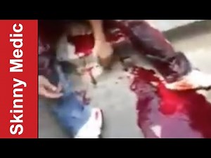 Suspect Shot In The Leg - After Action Medical Report