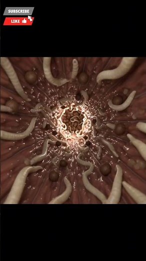 Explore the Human Colon in 3D Ascaris infection simulation.