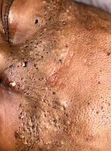 3.1M views · 3.9K reactions | ⛔⛔⛔Alors vous passez faire un soin de visage ou allez attendre d'avoir cette même peau ??? ⛔⛔⛔Nous sommes ouvert de 10h à 19h contact :0575949298 palmeraie face à la pharmacie Marie esther immeuble rouge et blanc au troisième étage porte blanche #vajacialtreatment #vajacialspecialist #abidjan225 #onglerie #institut #mariage #beaute #abidjanplaces #conseils | Cascade spa by EK | Facebook