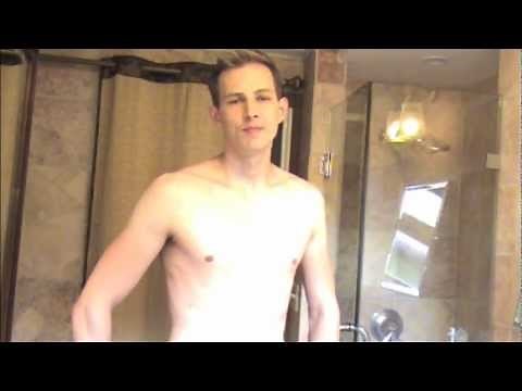 Day 730 (YEAR 2) Pectus Excavatum Modified Ravitch - Full Update