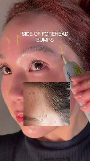 How to Use Retinol: Celimax Retinal Tips