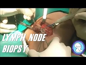 LYMPH NODE BIOPSY/ BIOPSIA DE LINFONODO CERVICAL