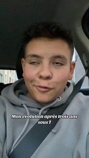 Évolution d'un transman après 3 ans de testostérone