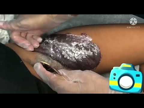 FULL PROCESS: BRAZILIAN WAXING/IN THREE PROCESS