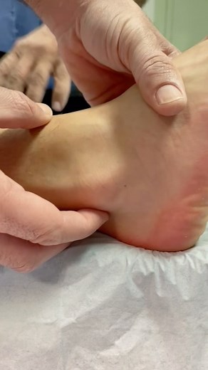 Luxación de tendones peroneos ( tobillo ) Peroneal Tendon Dislocation ( ankle) | Doctor Lara Trauma Sevilla y Huelva