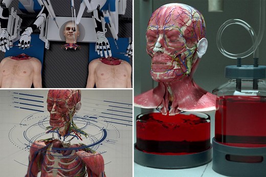 Startup claims they have created AI head transplant system, plans to perform first procedure within decade