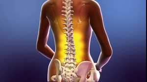 SitSmart Core Traction