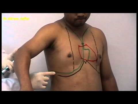 Surface anatomy of the thorax + Anki flashcards