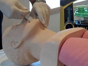 Insert an Oropharyngeal Airway