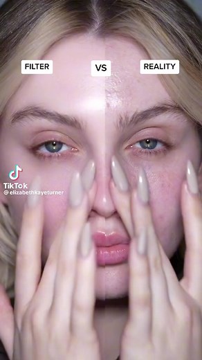 La piel de porcelana no existe bebés | Selena Valdez | Facebook