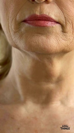 37K views · 19 reactions | Your neck shows signs of aging before your face does. Learn how to prevent and tighten saggy turkey neck skin without surgery. Read more>> bit.ly/49dTmNQ | Purple Clover | Facebook