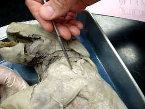 Fetal Pig Dissection: Skeletal Muscle System