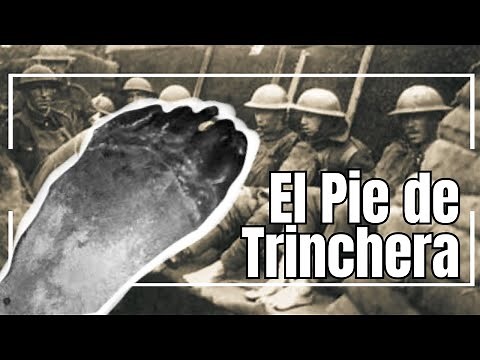 El PIE DE TRINCHERA y sus Estragos- JorJoa