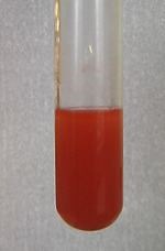 Antimony triiodide - Alchetron, The Free Social Encyclopedia