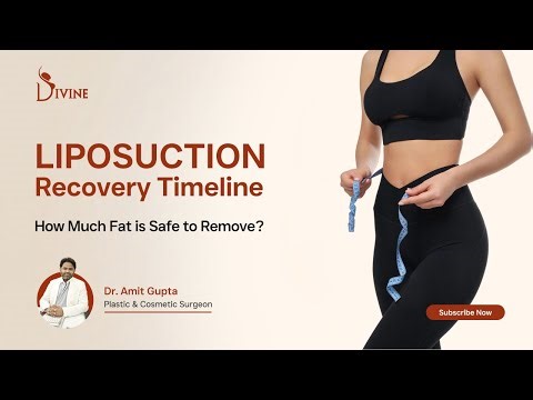 Liposuction Recovery Timeline & Safe Fat Removal Limits Explained | Must Watch Before Surgery