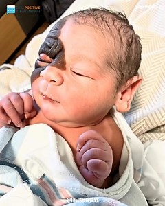 When little Winry was born, her “strange birthmark” left everyone speechless 😲 | Dream Crafters