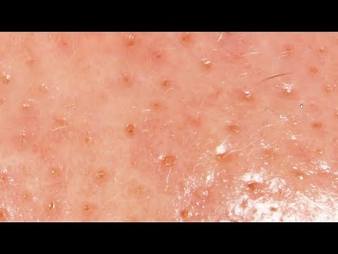 This is a NOSE! -- DONG