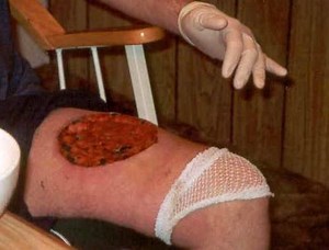 Brazilian Poisonous & Venomous Snakes and Spiders in Brazil Seen When On Vacation