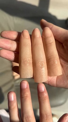 Every detail matters — from skin tone to texture to comfort. 🌿 Our custom silicone prosthetics are handcrafted to look and feel as natural as possible. Whether it’s a toe, hand, or foot — we focus on precision, realism, and confidence in every design. Experience innovation, compassion, and true craftsmanship in every piece. ✨ Hashtags: #Prosthetics #SiliconeProsthetics #CustomProsthetic #ProstheticDesign #MedicalInnovation #Rehabilitation #ProstheticClinic #ArtificialLimb #MedicalAesthetics #Cu