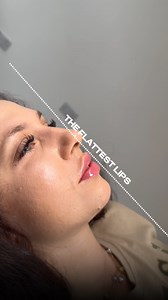 2.6K views · 15 reactions | The Flattest Lips You’ll Ever See ✨ No...