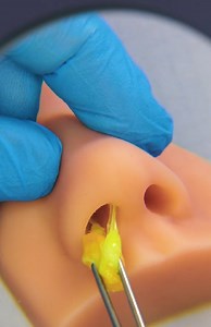 12K views · 18 reactions | When Doctors Extract the Unexpected | Health is Wealth | Facebook