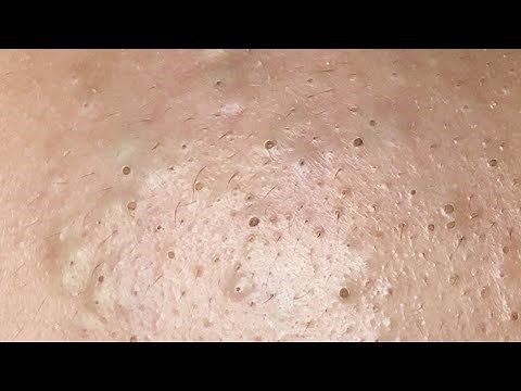 Satisfying Relaxing with Sac Dep Spa #423