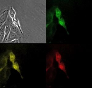File:Bacillus-sphaericus-Binary-Toxin-Elicits-Host-Cell-Autophagy-as-a-Response-to-Intoxication-pone.0014682.s008.ogv - Wikimedia Commons