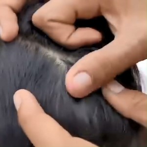 14K views · 101 reactions | Getting out all lice from short hair | Natural Lice | Facebook