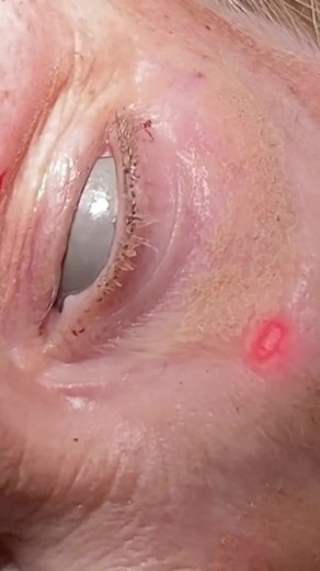 #laser #skinbydrazi #dermatologist