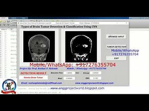 Types of Brain Tumor Detection Using CNN Matlab Project With Source Code Brain Tumor Segmentation