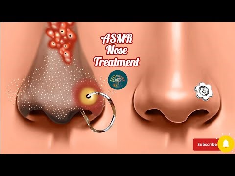 ASMR Nose Piercing Infection Treatment Animation | Infected Nose Ring Cleaning & Healing