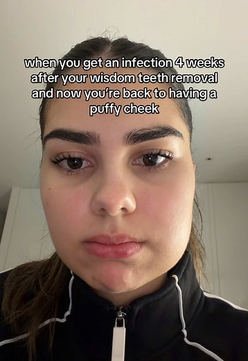 Wisdom Tooth Infection 4 Weeks After Removal: Causes & Treatment