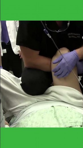 Artificial Hip Dislocation Reduction Procedure