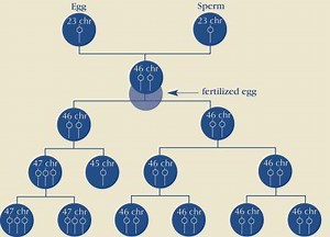 Causes of Down Syndrome