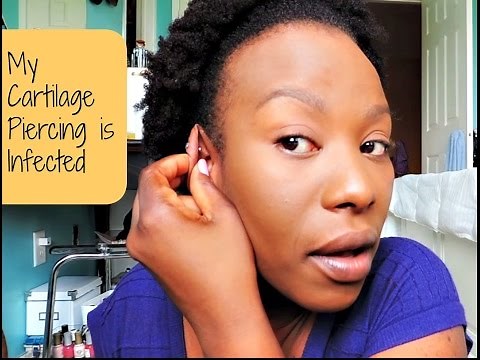 Cartilage Piercing Update: Infection & Solution feat. Demo