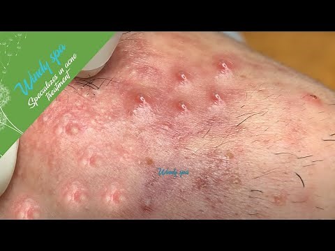 Make Your Day Relaxing with Windy Spa#15