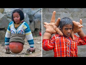 15 Most Unusual Kids In The World