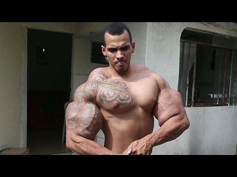 Bodybuilder nearly dies after bicep injections