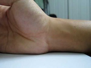 eulerian video magnification of wrist pulse