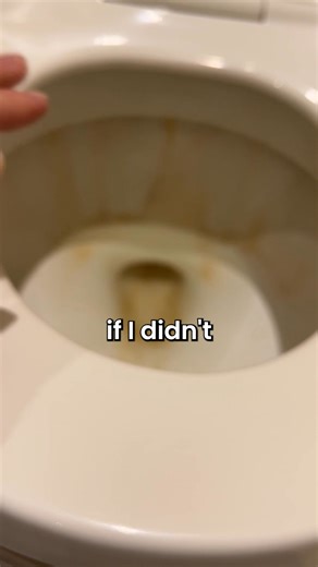 Technology to clean your toilet!? That gross ring in your toilet bowl comes from mineral buildup. Krazy Klean destroys minerals before they bond, leaving your toilet sparkling clean. Too good to be true? Try it for yourself with zero risk. Hate having a clean toilet? Krazy Klean has a 10-year return and warranty. | Krazy Klean
