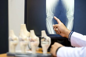 Knee Replacement Surgery | Surgical Treatment Options | Exactech