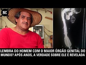 Lembra do homem com o maior órgão do mundo? Após anos, a verdade sobre ele é revelada