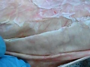 Cat Dissection- Abdominal Muscles