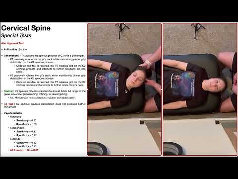 Alar Ligament Stress Test (with Rotation & Sidebending) | Demonstration & Interpretation