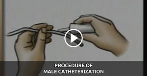 Procedure of Male Catheterization - QD Nurses