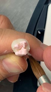 Layering zirconia for a posterior crown. How to create tooth morphology! | LSK121 Oral Prosthetics