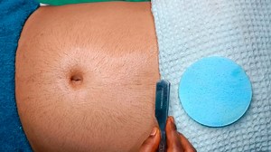 stomach hair removal female tummy hair removal women tummy shaving tummy shaving #stomach #hairremoval #wax @sonimakeover | Soni Makeover