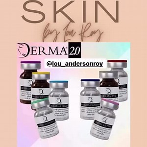 Last three model appointments available for our Famous Derma 2.0 EYE treatment to say goodbye to your eye bags!!! This treatment drains the swollen area under your eye!!! Mean the Eye Bag area DISAPPEARS!!!! These appointments at the reduced rate of £99 per session (usually £199) Pictures will be taken for portfolio purposes!!! Appointments available tomorrow at 4:00 & 4:30 Dm us now to book! @lou_andersonroy #lastudio #shoreham #salon #aesthetics #skinbooster #filler #undereyecircles #eyebooste