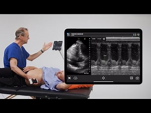 How to Measure TAPSE